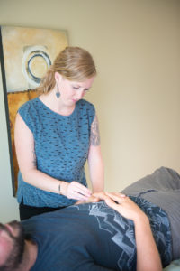 Allie Machen placing acupuncture needles into the hands of her male patient.