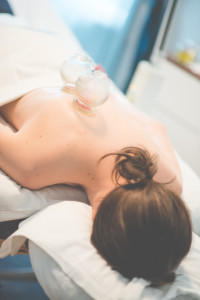 Cupping on the back of a female patient.